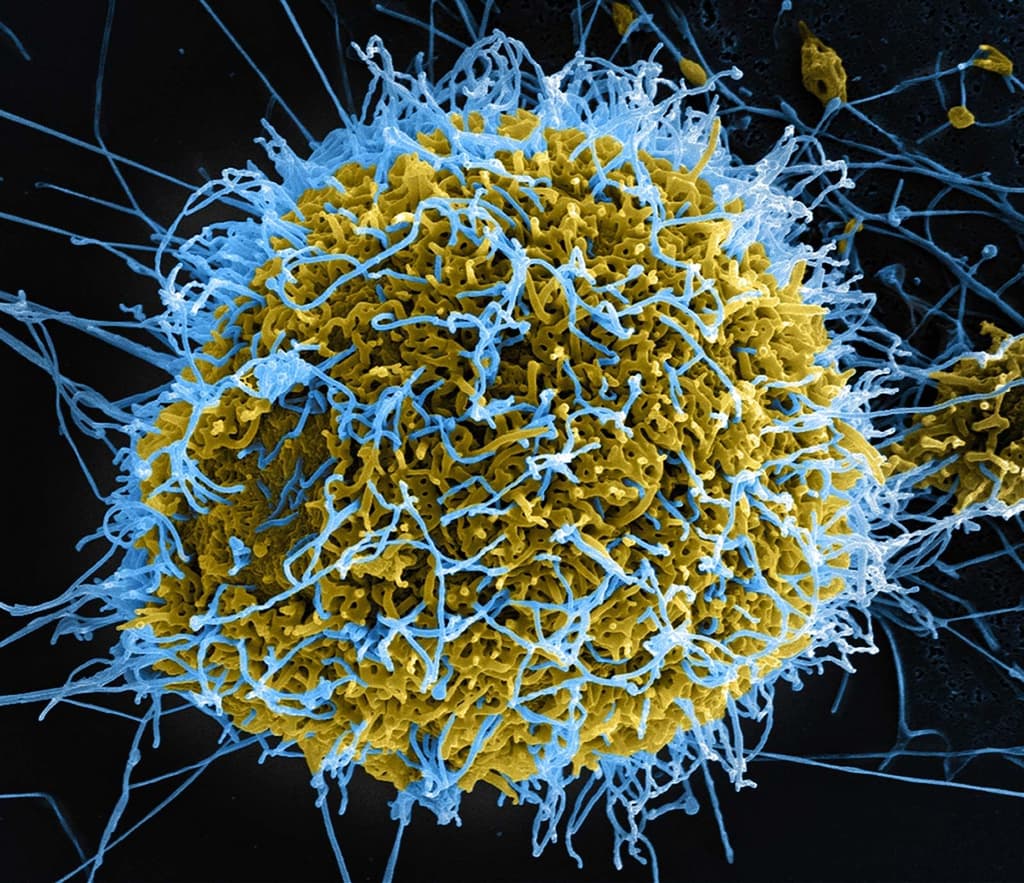 Ebola pandemic in 2026? card icon